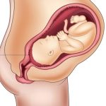 5 Key Essentials For A  Healthy  Placenta