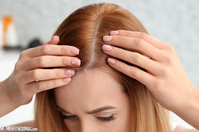 Top 5 Hair Loss Solutions in 2022