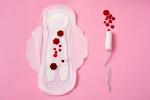 Menorrhagia: a gyneacologists guide to heavy menstrual bleeding