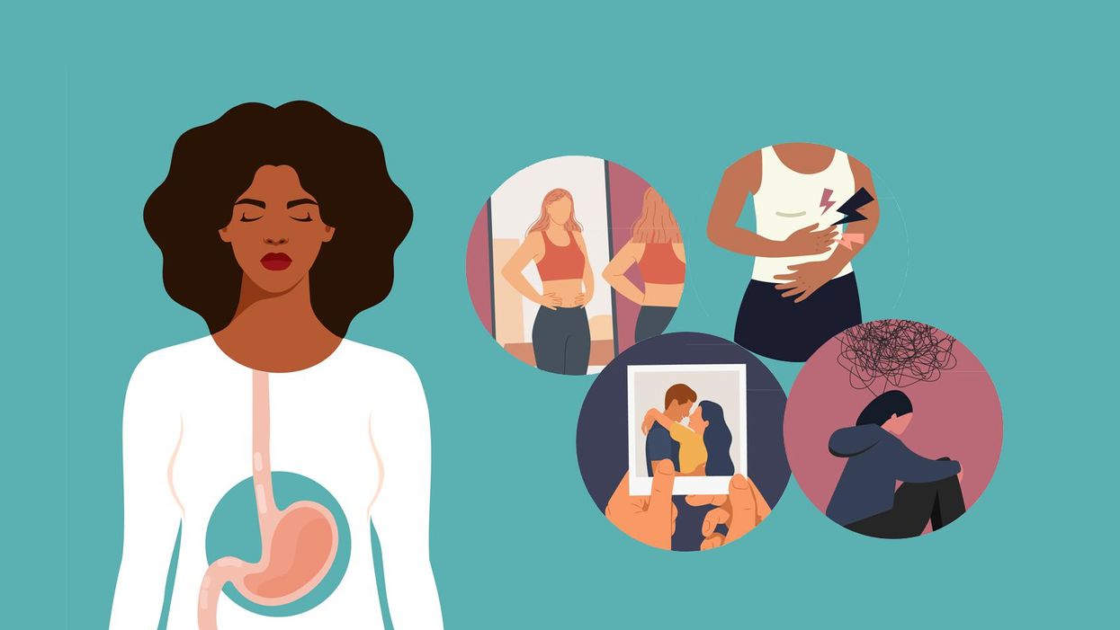 Social and Emotional Effects of Life With Inflammatory Bowel Disease (IBD)