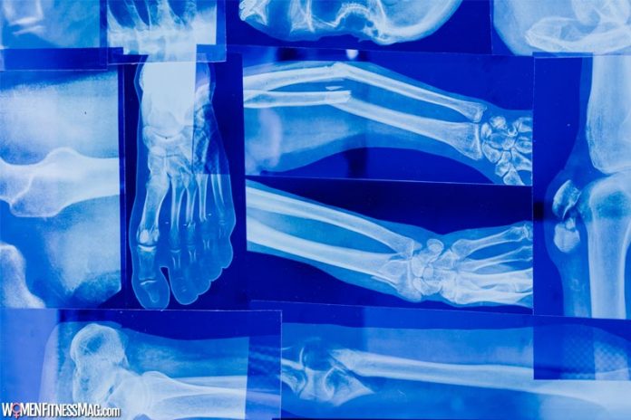Most Common Types of Orthopedic Surgeries