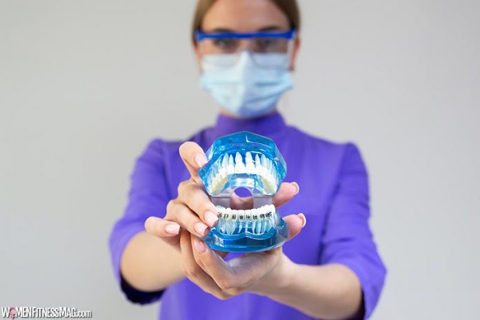 Dental Implants: A Comprehensive Guide