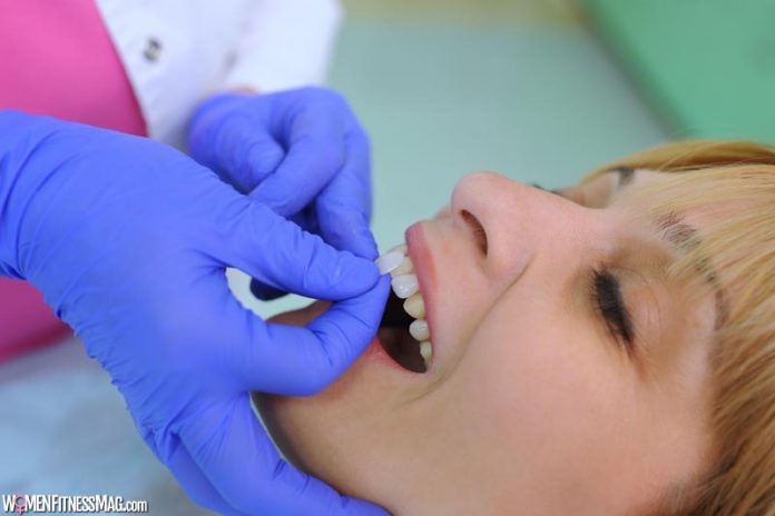 Dental Veneers vs Implants: What’s Best For You?