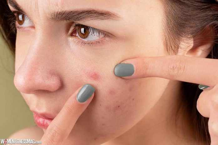 Top 5 Steps to Get Rid of Blemishes