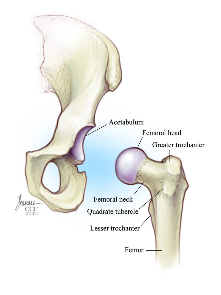 Femoroacetabular Impingement (FAI): a Hip Dysfunction