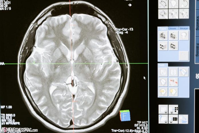 The Latest Research on Alzheimer’s and Dementia