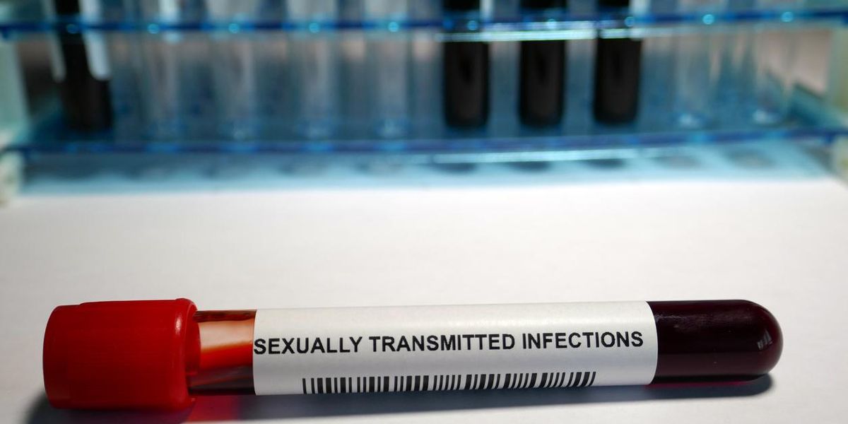 You Can Test Yourself for an STI at Home — but Should You?