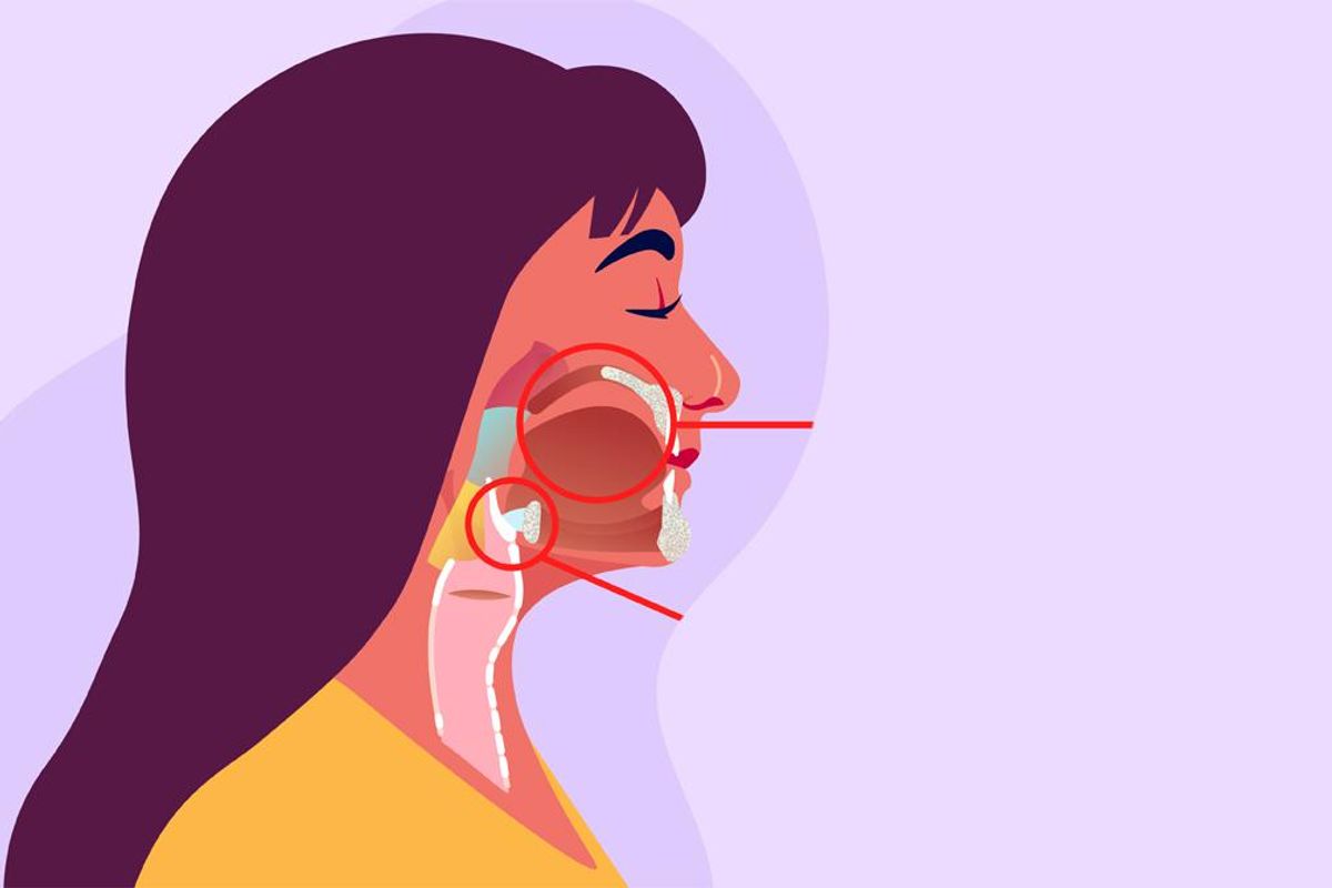 What Is the Link Between HPV & Head and Neck Cancers?