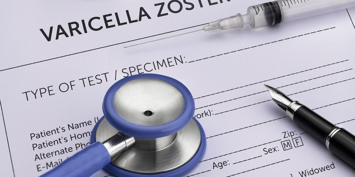 What’s the Connection Between Chickenpox and Shingles?