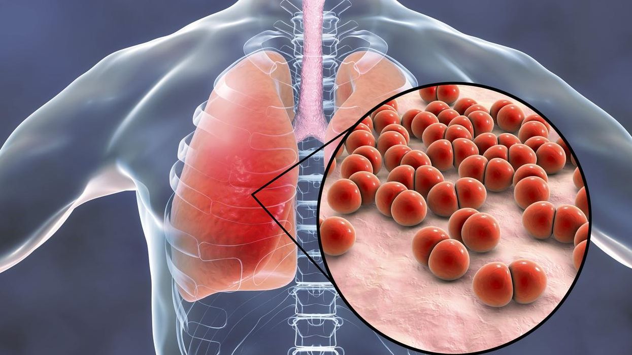 What Is Pneumococcal Disease?
