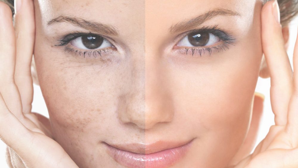 Skin-Brightening Peptide: Decapeptide-12 