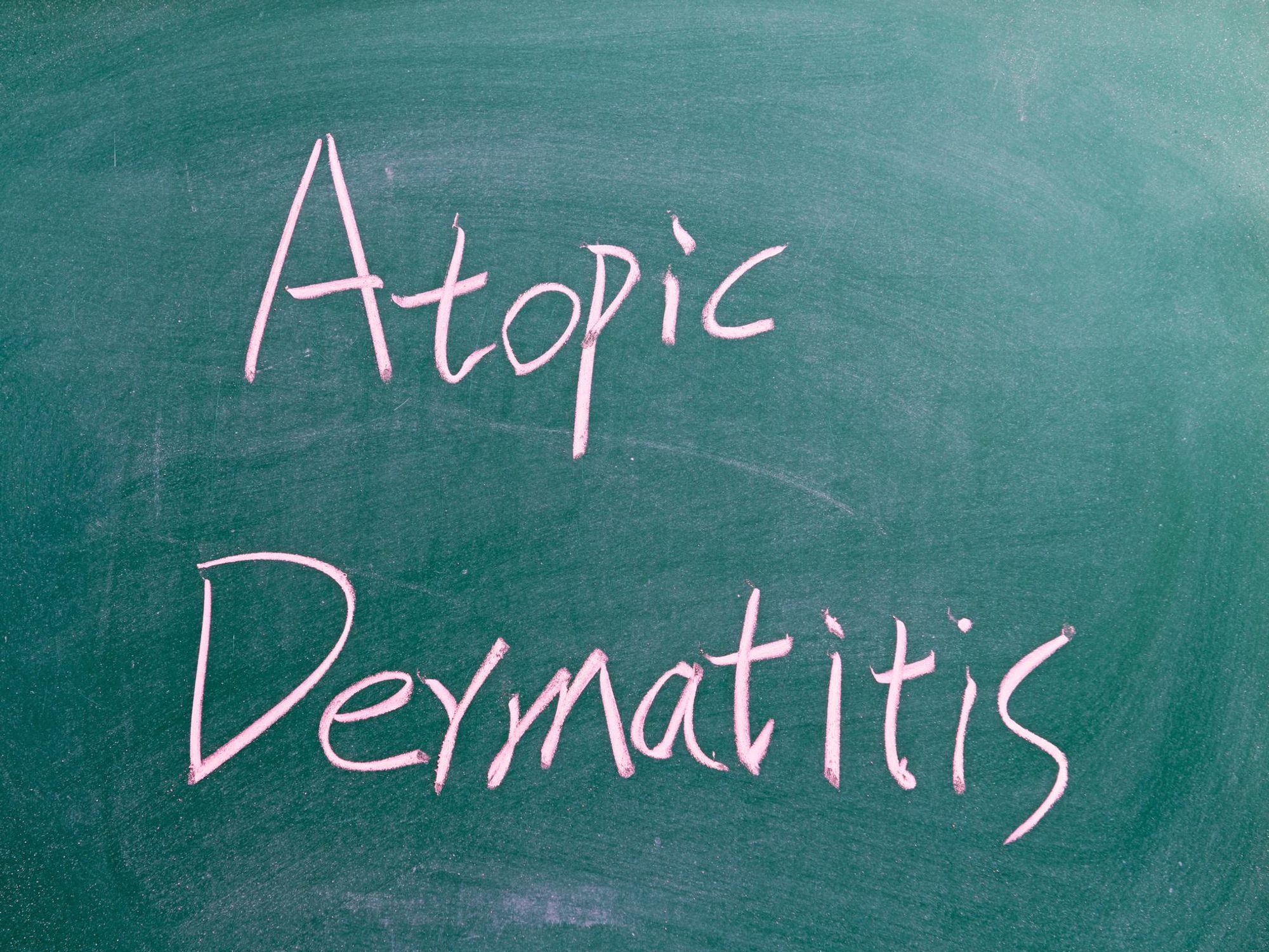 Living With Atopic Dermatitis (AD)