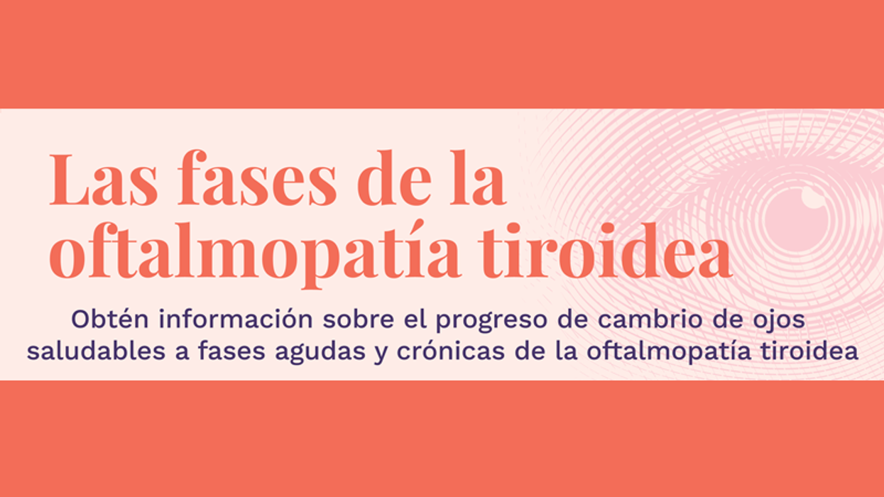 Las fases de la oftalmopatía tiroidea