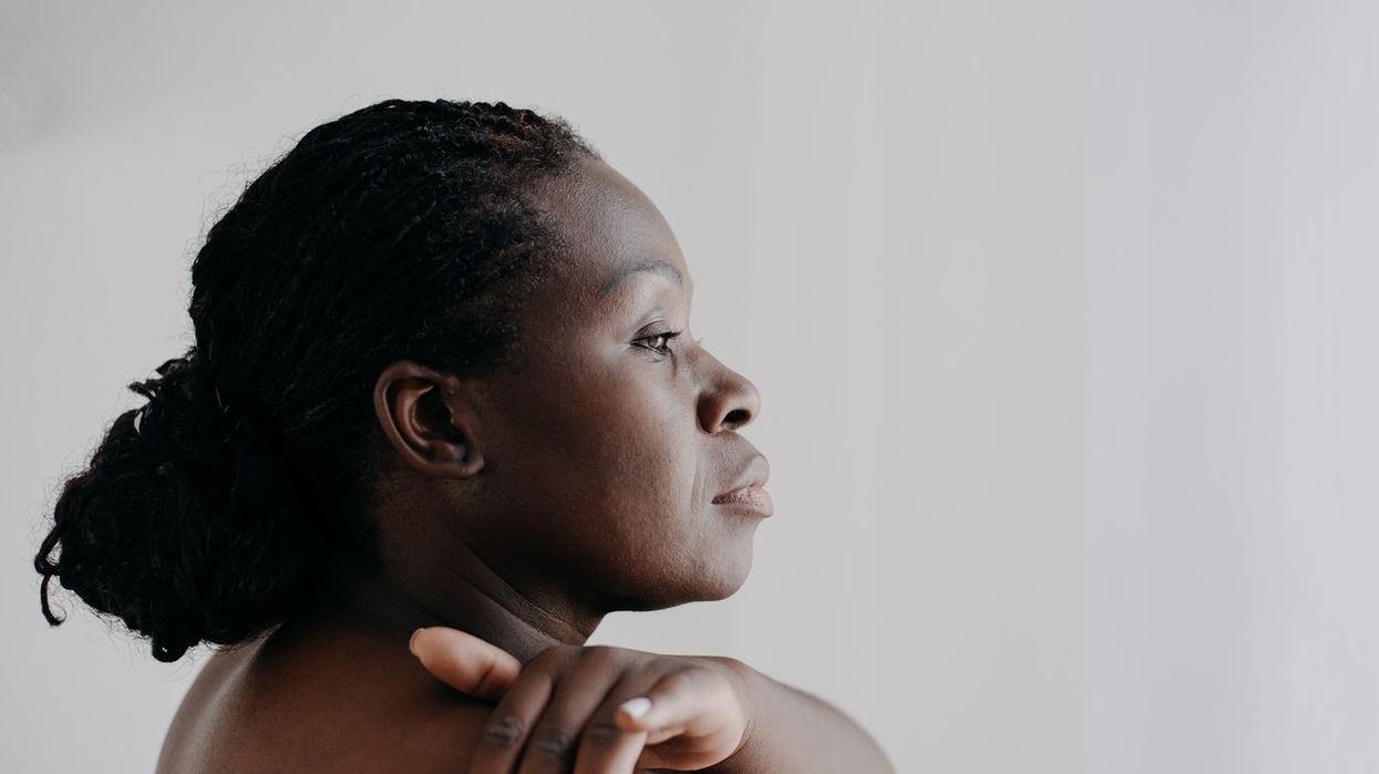 Why Are People of Color More Likely to Die from Skin Cancer?