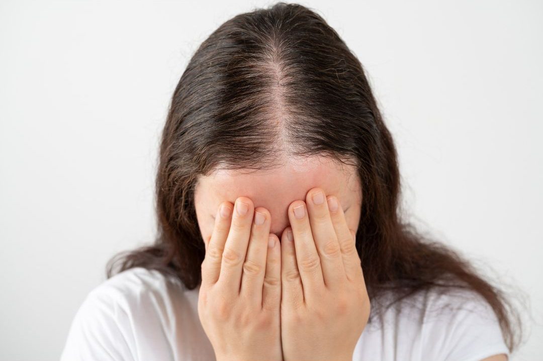 What Are The Most Common Causes Of Hair Loss Among Women?