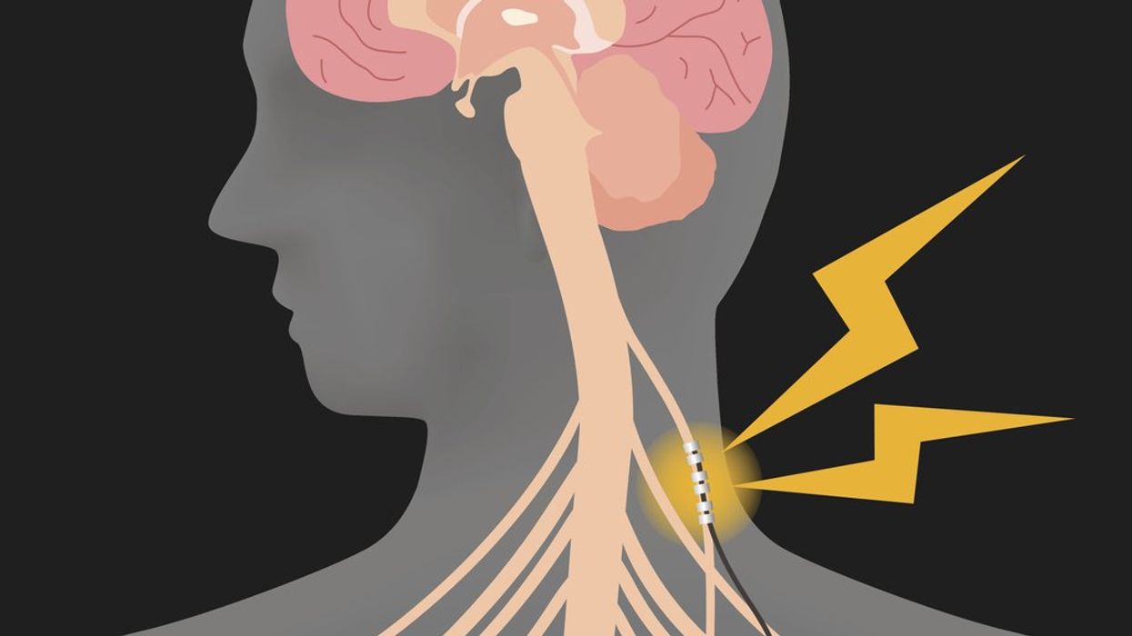 What Is the Vagus Nerve?