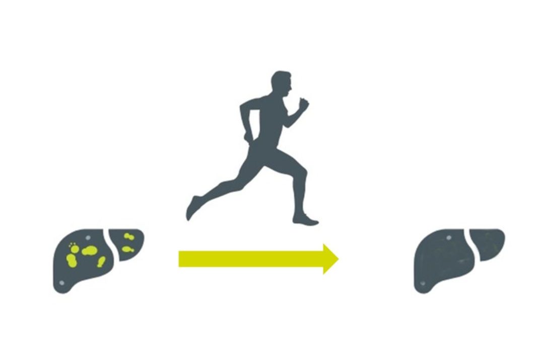 NAFLD and Physical Exercise: Take Charge!