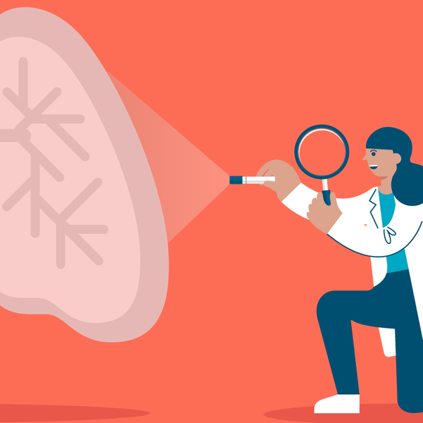 Entender los varios tipos de cáncer de pulmón