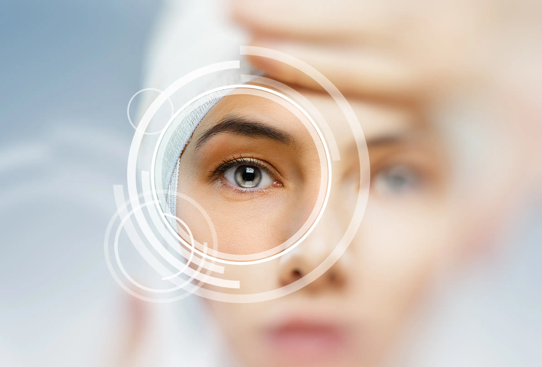 Exfoliation Syndrome: a Cause of Glaucoma