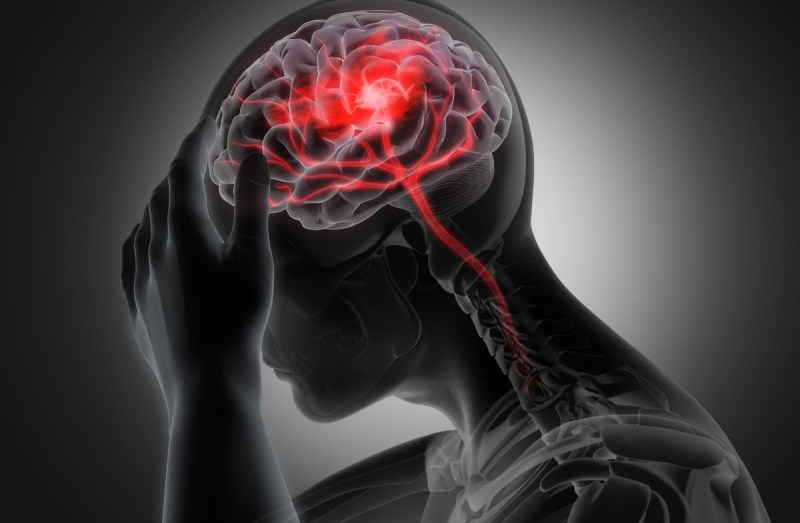 Unraveling Migraines: Causes, Symptoms, And Innovative Relief Methods