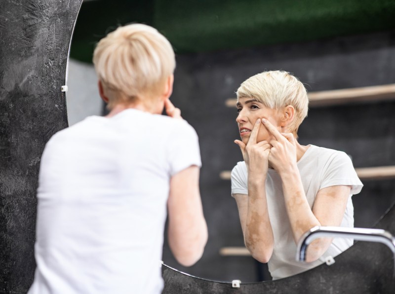 Benzoyl Peroxide Versus Salicylic Acid for Women Over 50