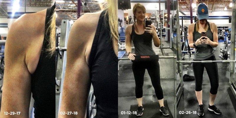 5 Easy Underarm Exercises to Alleviate Fat