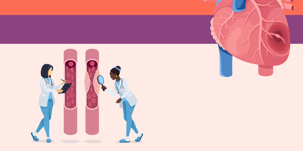 Are You at Risk for Heart Disease?