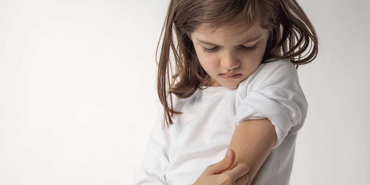Managing Atopic Dermatitis in Kids
