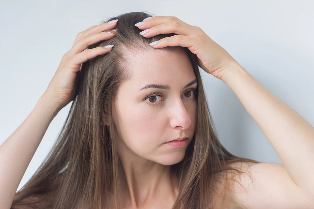 Understanding the Causes of Female Hair Thinning