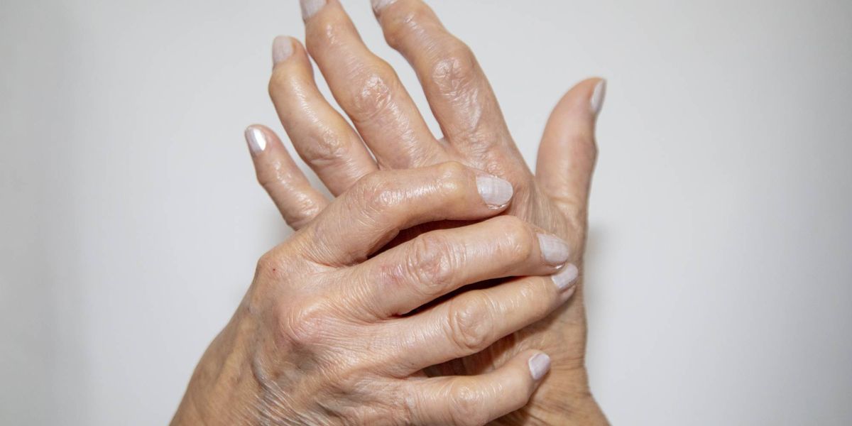 Facts About Rheumatoid Arthritis – HealthyWomen